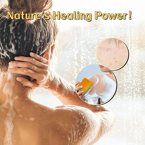 Kojic Acid & Turmeric Brightening Soap – Dark Spot Remover with Vitamin C, Retinol & Lemon Oil